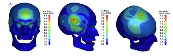 Research shows tennis ball co<em></em>ncussions are rare, but possible